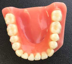 denture